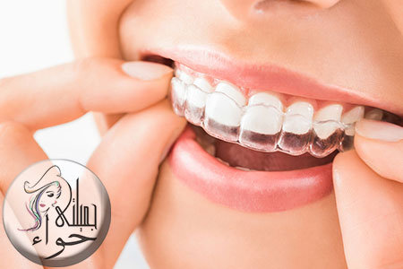 أنواع تقويم الأسنان الشفاف وعيوبه ومميزاته