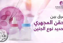 الحقن المجهري وتحديد نوع الجنين